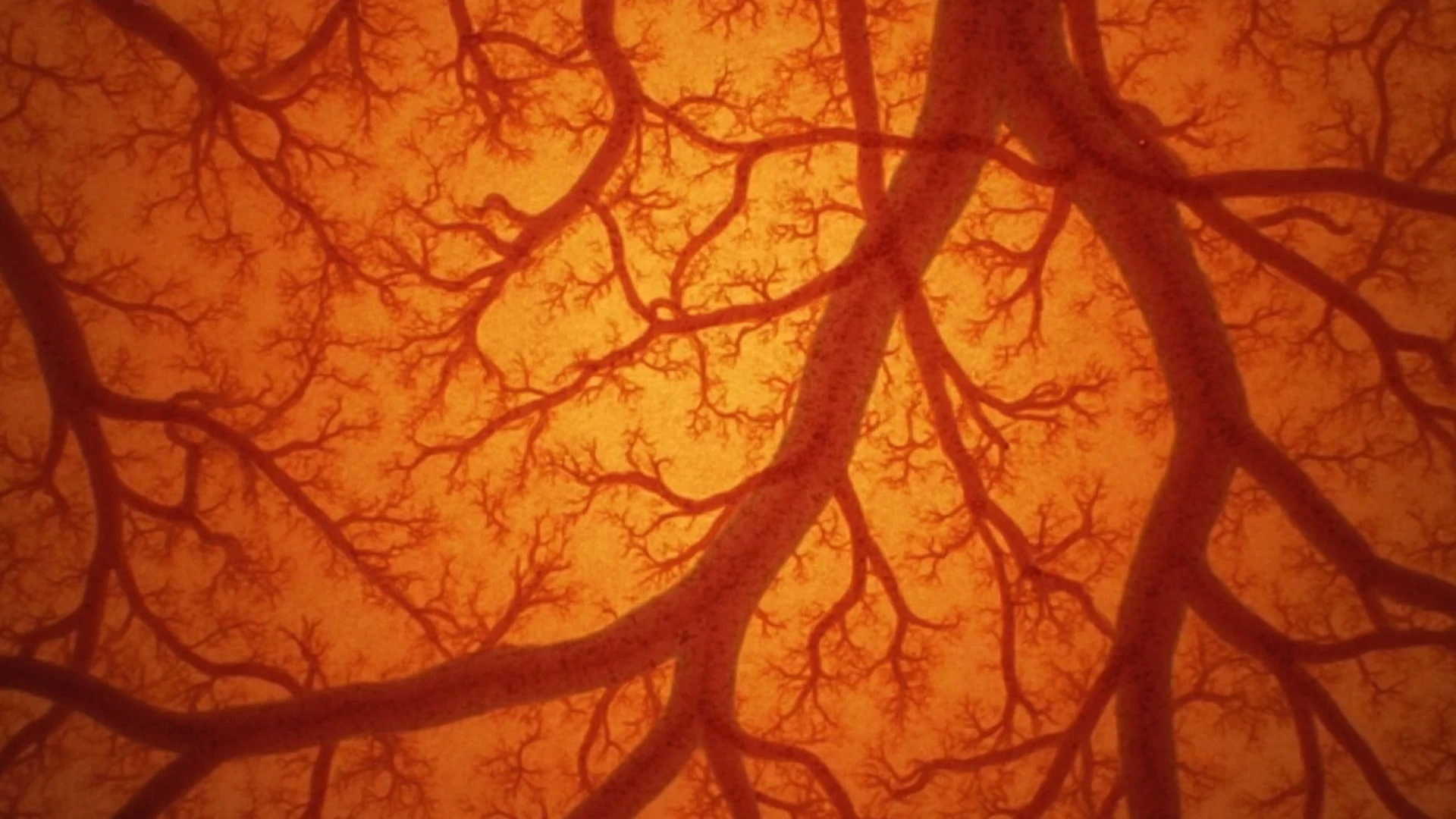 В фокусе атерогенез