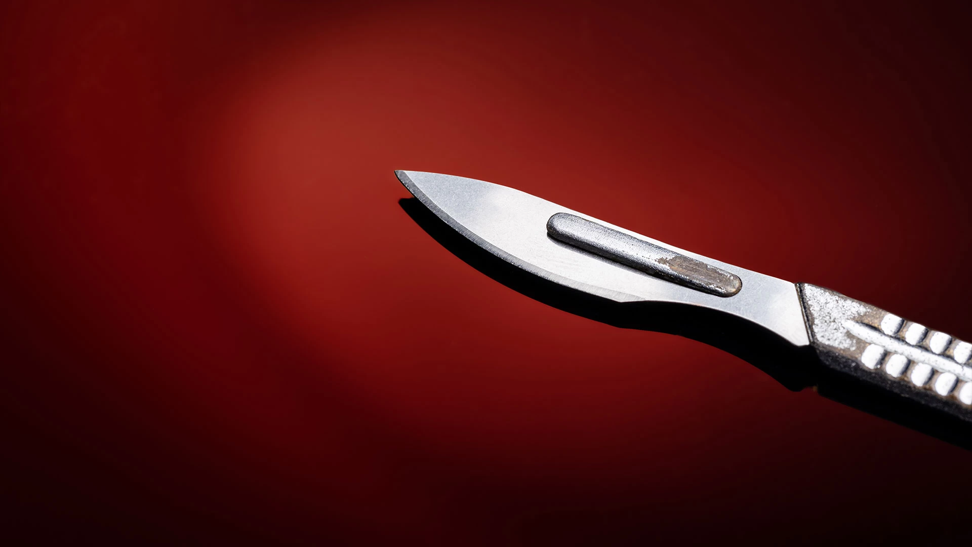 Рецидивирующая эндометриальная гиперплазия: что нужно знать клиницисту? 