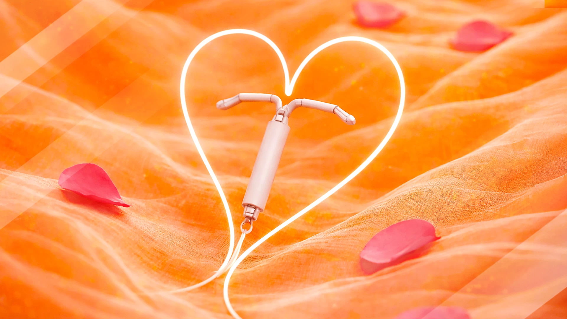 Лечебные эффекты и преимущества гормональной внутриматочной системы